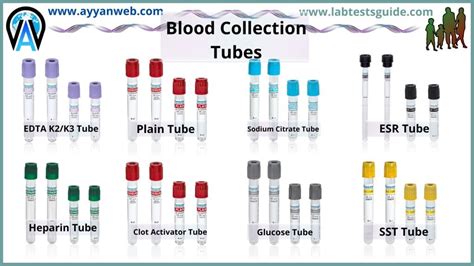 blood collection tube inspection